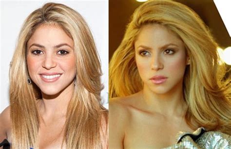 shakira breast implants|Shakira Artistfacts